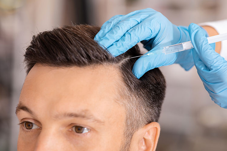 PRP (Platelet-Rich Plasma) Therapy For Hair Loss